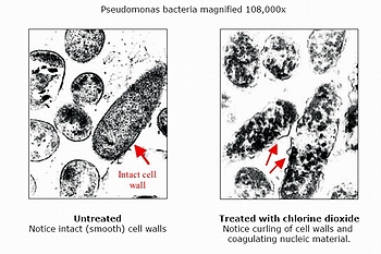 bacterianuked3